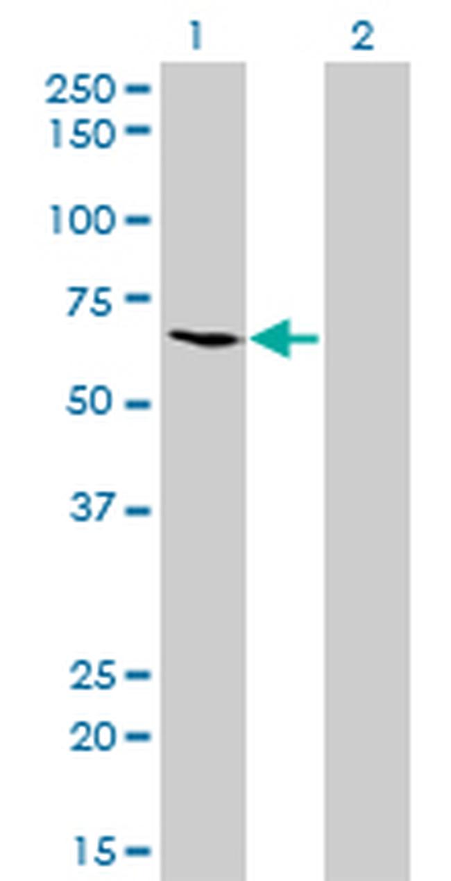 ME1 Antibody in Western Blot (WB)