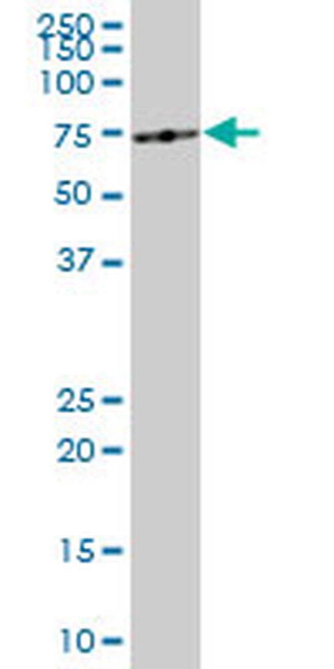 ME1 Antibody in Western Blot (WB)