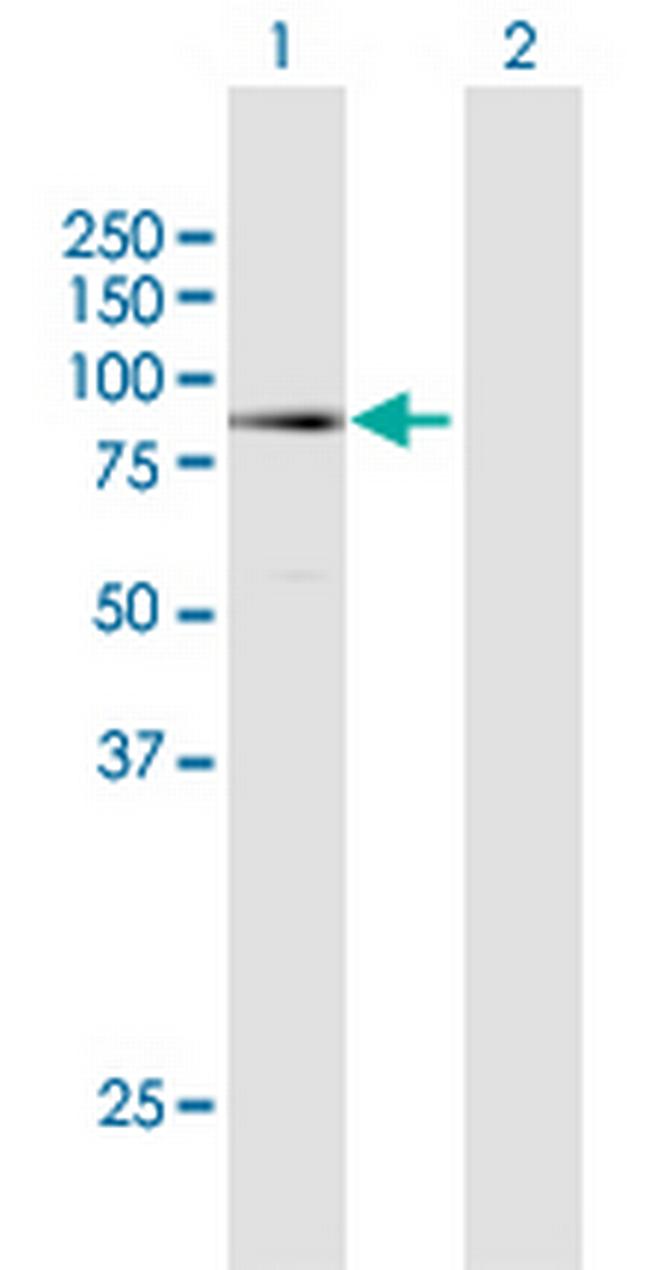 MECP2 Antibody in Western Blot (WB)