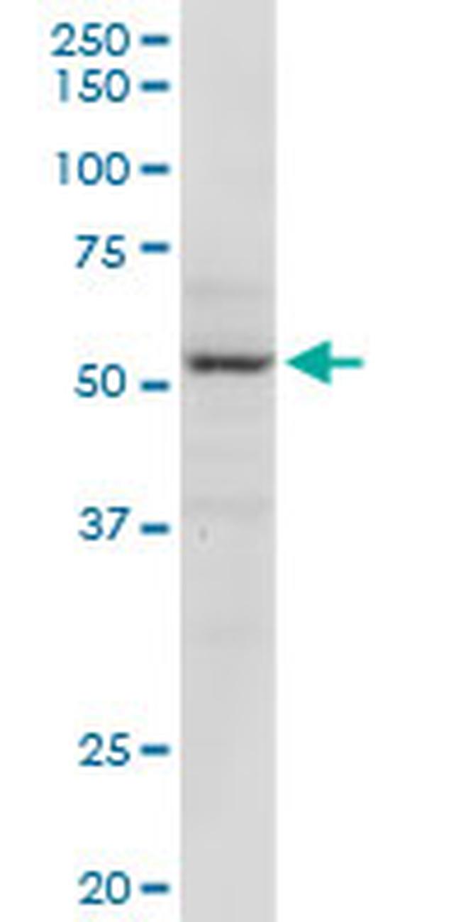 MECP2 Antibody in Western Blot (WB)