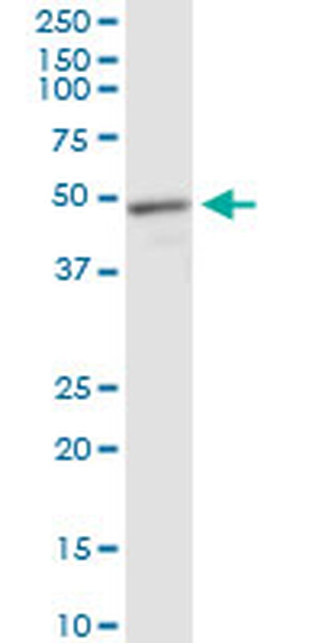 MECP2 Antibody in Western Blot (WB)