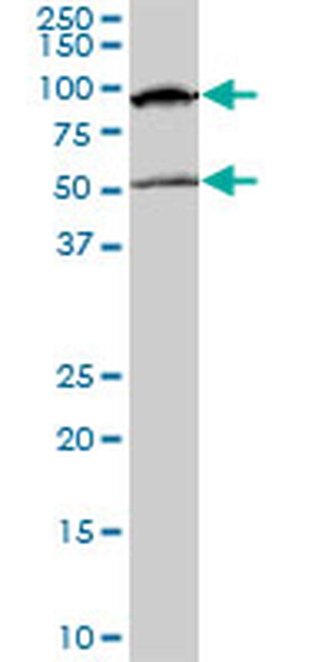 MECP2 Antibody in Western Blot (WB)