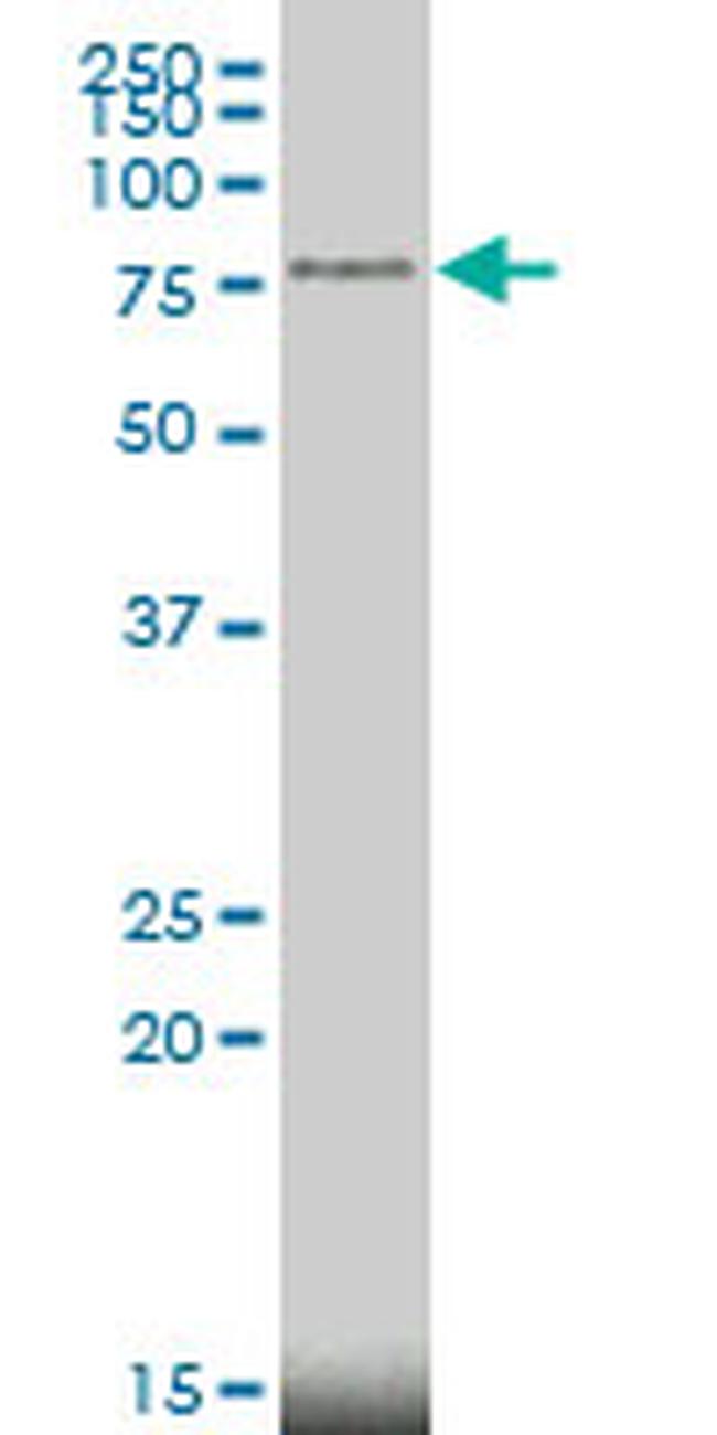 MECP2 Antibody in Western Blot (WB)