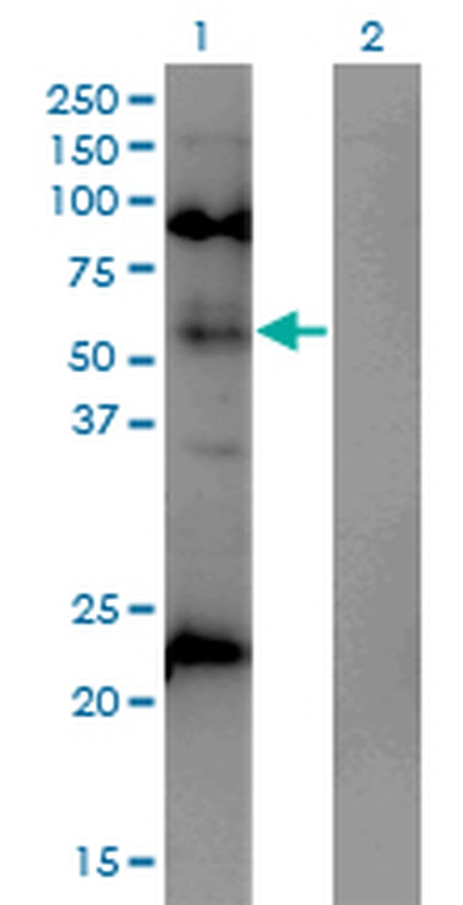 MECP2 Antibody in Western Blot (WB)