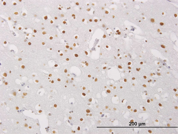 MECP2 Antibody in Immunohistochemistry (Paraffin) (IHC (P))