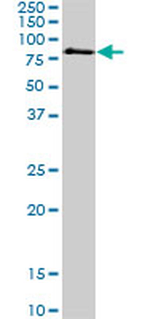 MECP2 Antibody in Western Blot (WB)