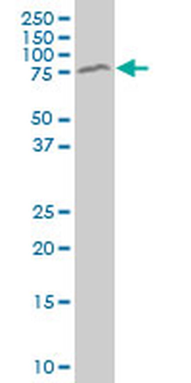 MECP2 Antibody in Western Blot (WB)