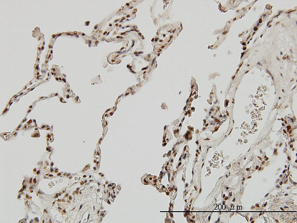 MEF2A Antibody in Immunohistochemistry (Paraffin) (IHC (P))