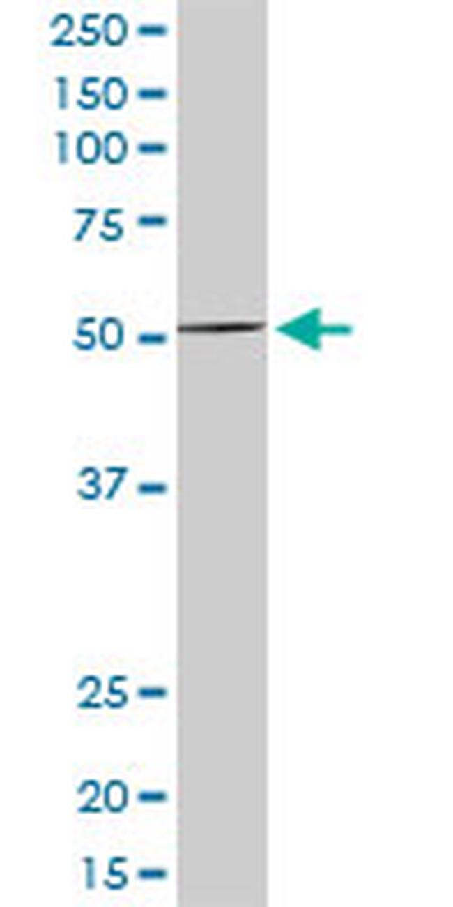 MEF2D Antibody in Western Blot (WB)