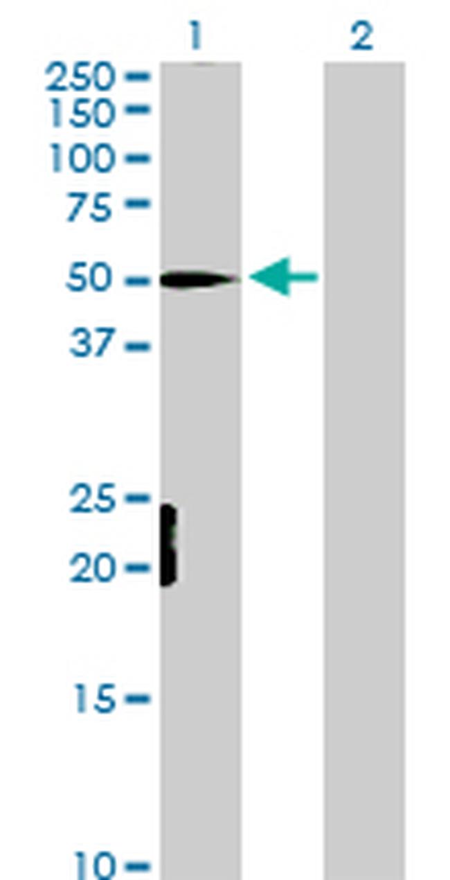 MEF2D Antibody in Western Blot (WB)