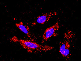 MAP3K1 Antibody in Proximity Ligation Assay (PLA) (PLA)