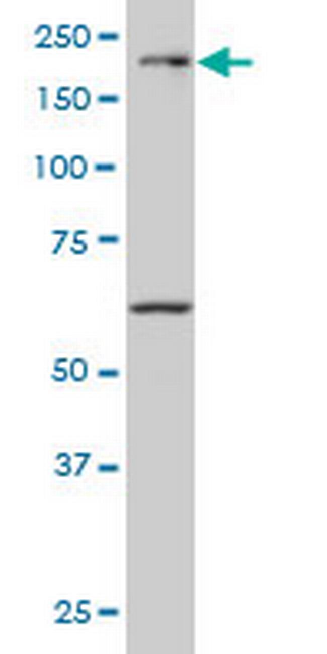 MAP3K4 Antibody in Western Blot (WB)