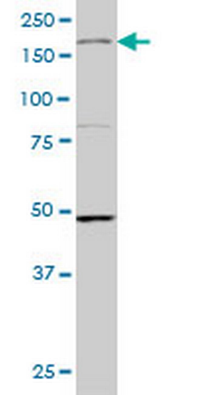 MAP3K4 Antibody in Western Blot (WB)