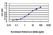 MAP3K4 Antibody in ELISA (ELISA)