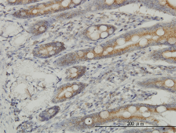 MAP3K4 Antibody in Immunohistochemistry (Paraffin) (IHC (P))