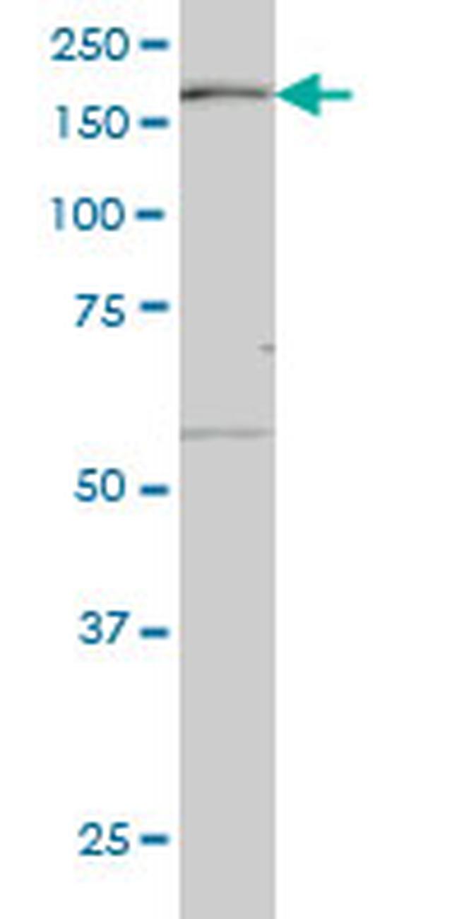 MAP3K4 Antibody in Western Blot (WB)