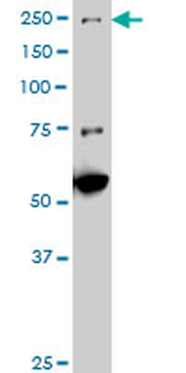 MAP3K4 Antibody in Western Blot (WB)