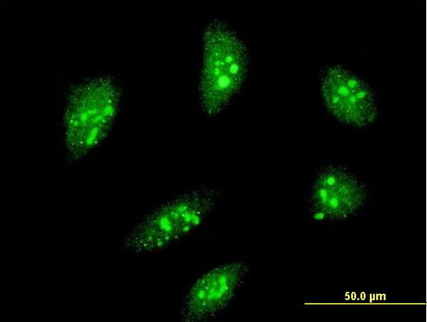 MEOX2 Antibody in Immunocytochemistry (ICC/IF)