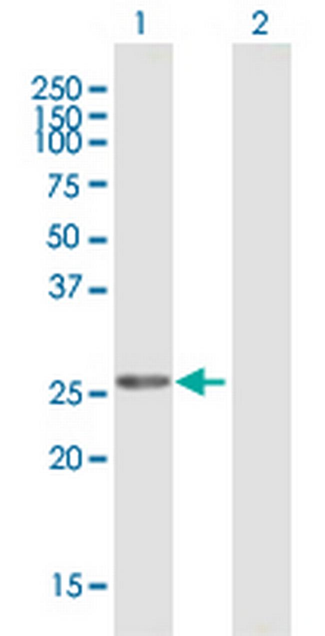 MFAP2 Antibody in Western Blot (WB)