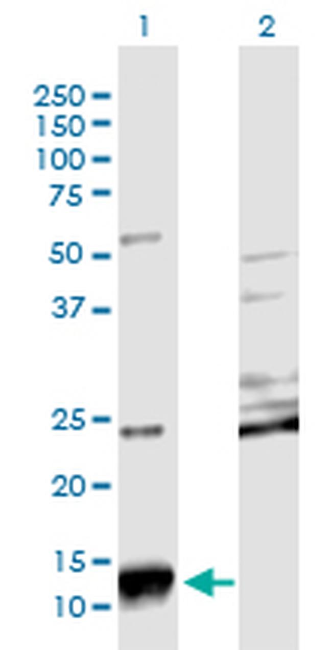 SCGB2A2 Antibody in Western Blot (WB)