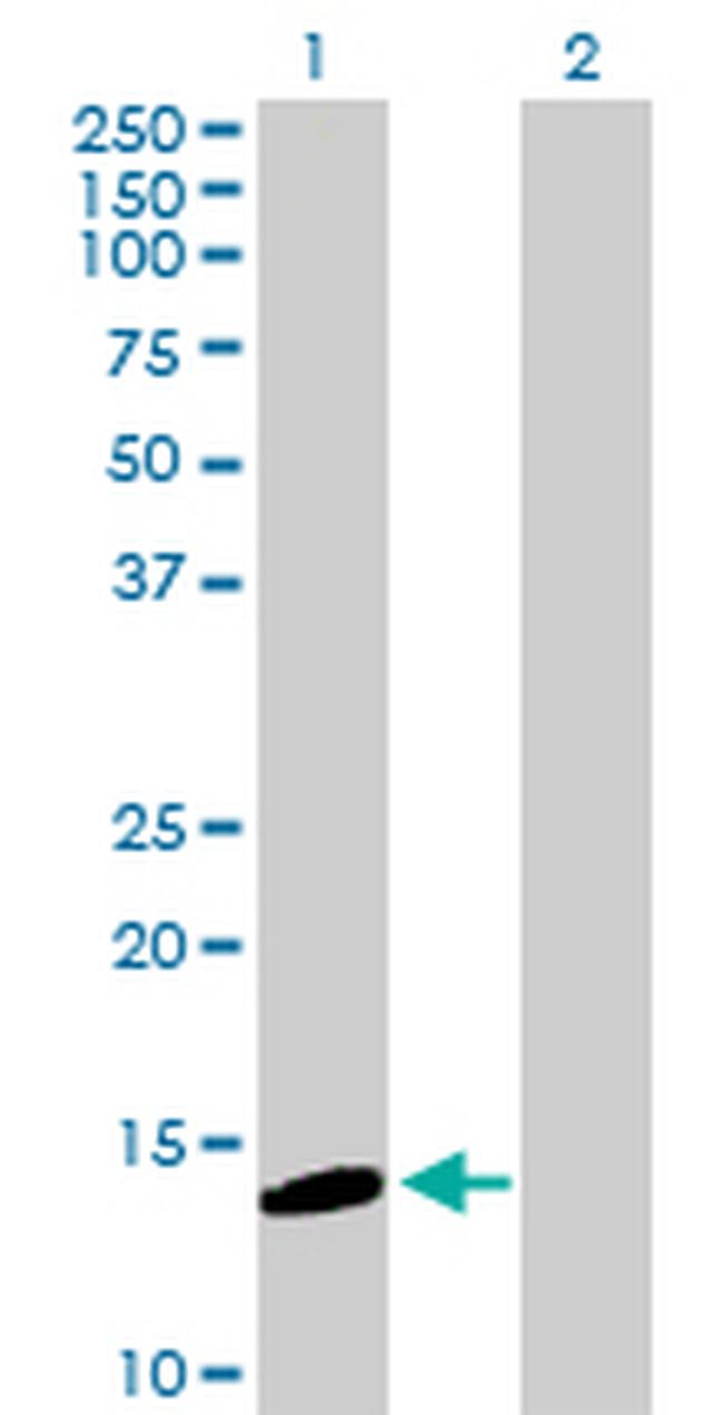 MGST2 Antibody in Western Blot (WB)