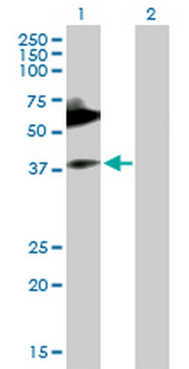 MICA Antibody in Western Blot (WB)