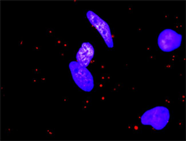 MMP1 Antibody in Proximity Ligation Assay (PLA) (PLA)