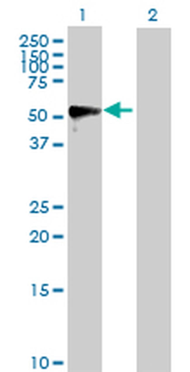 MMP1 Antibody in Western Blot (WB)