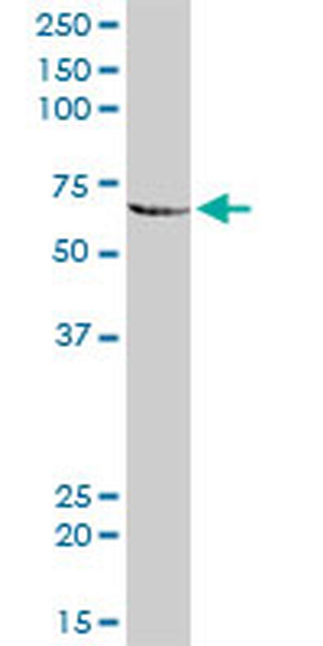 MMP3 Antibody in Western Blot (WB)