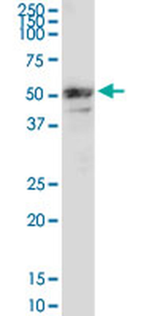 MMP3 Antibody in Western Blot (WB)