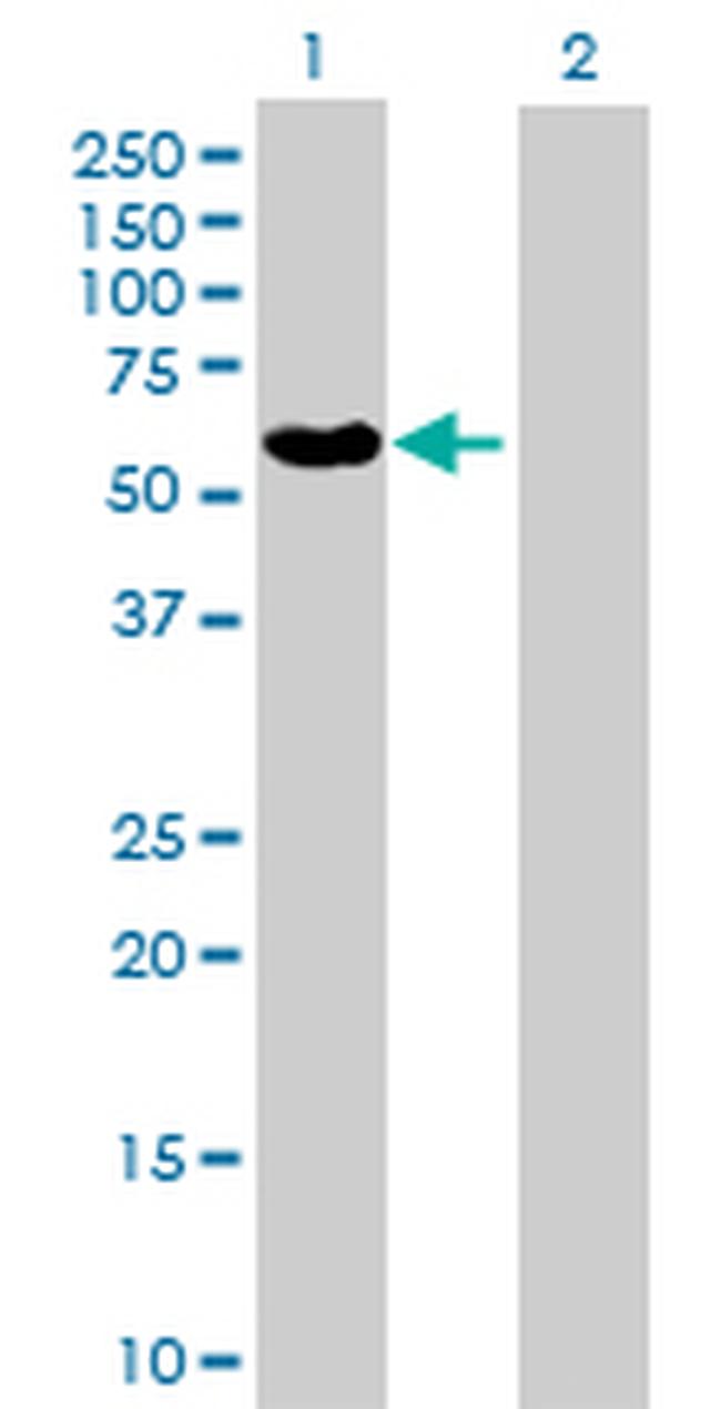 MMP3 Antibody in Western Blot (WB)