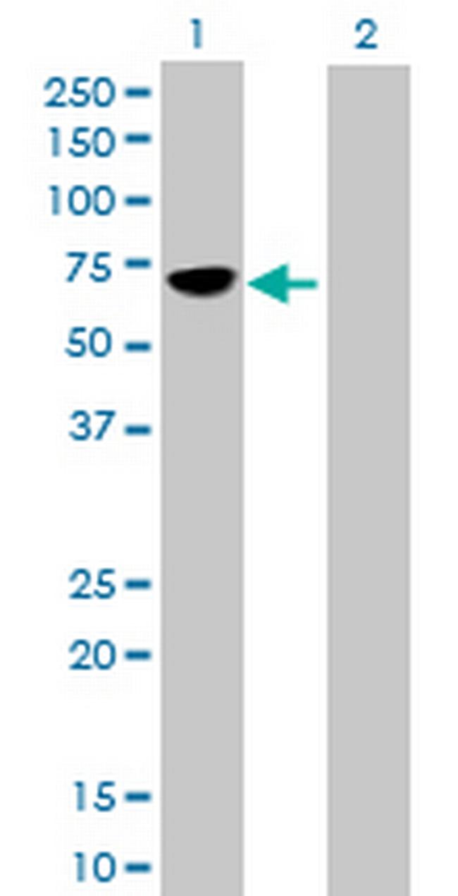 MMP8 Antibody in Western Blot (WB)