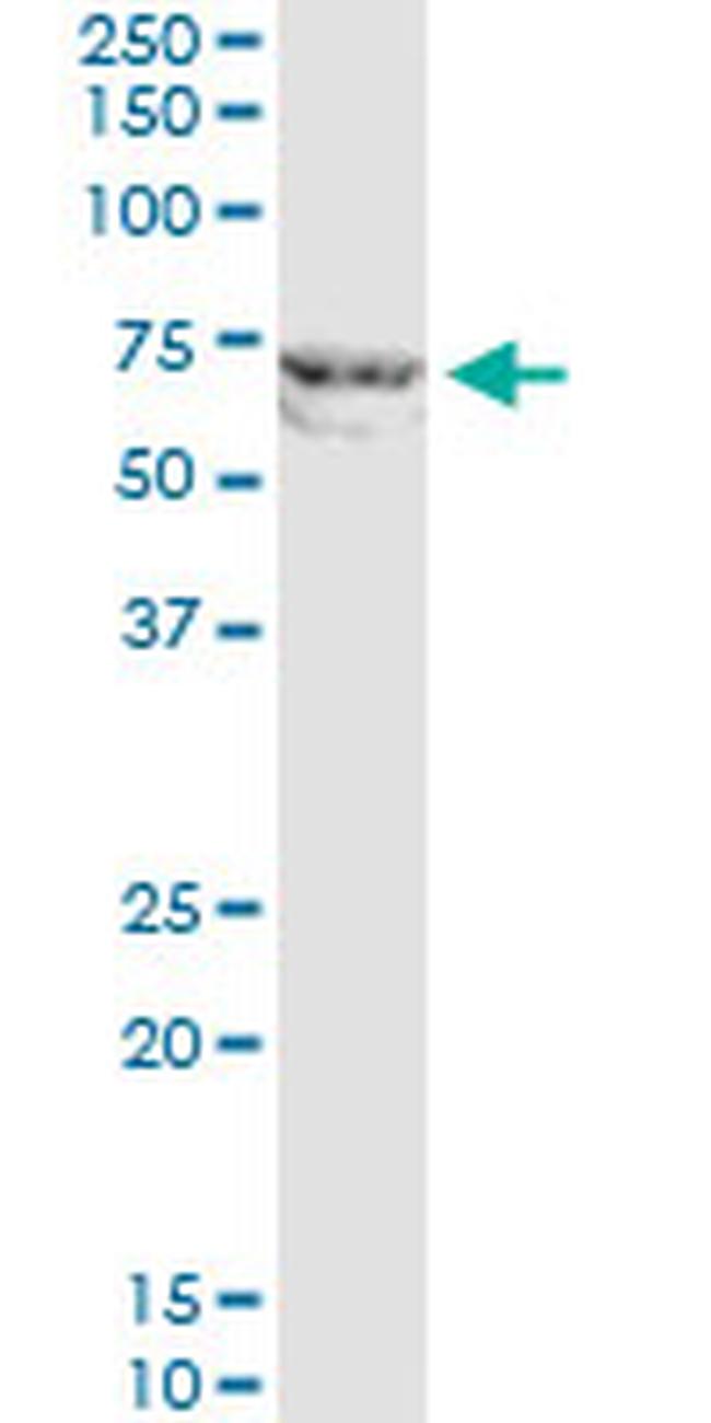 MMP12 Antibody in Western Blot (WB)