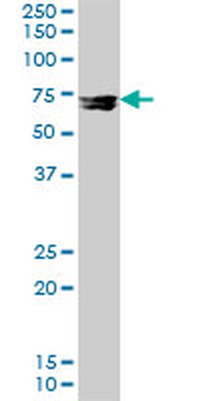 MMP12 Antibody in Western Blot (WB)