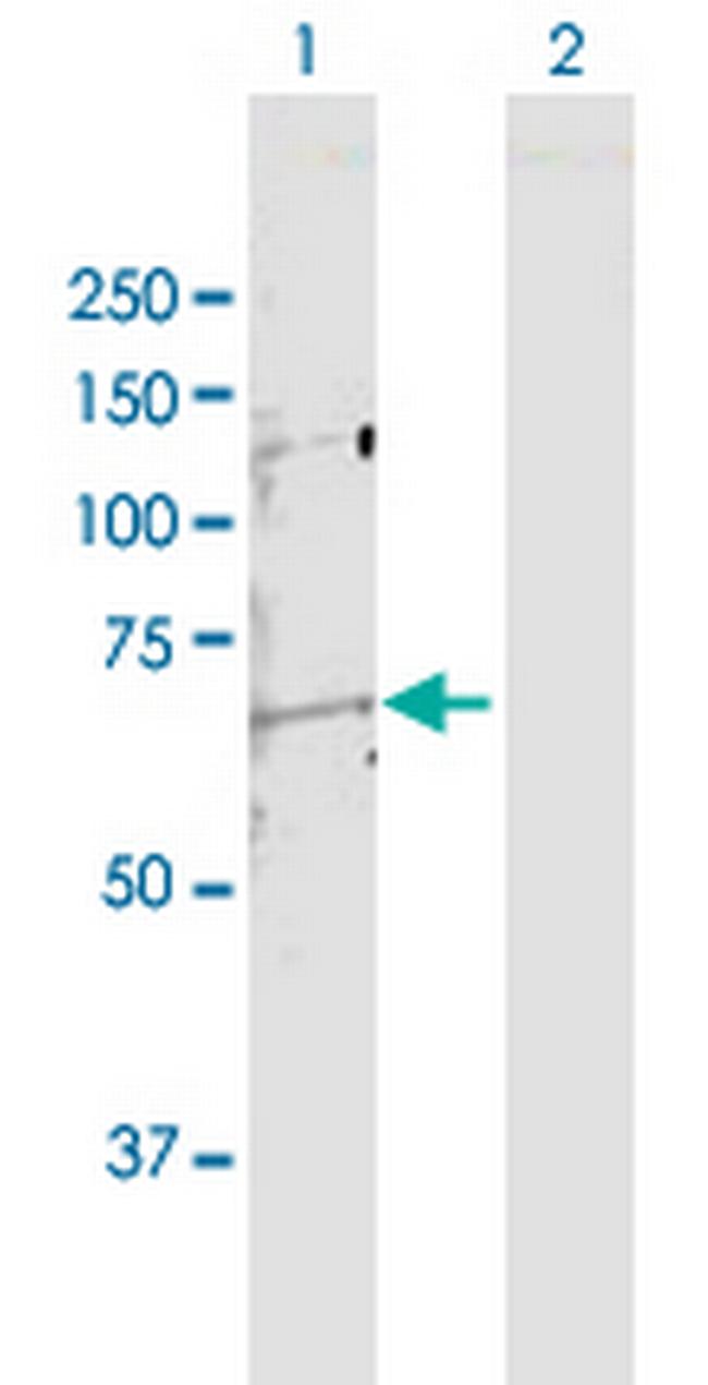 MMP14 Antibody in Western Blot (WB)