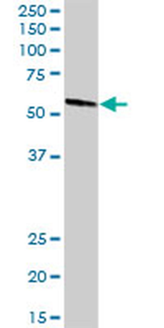 MPP1 Antibody in Western Blot (WB)