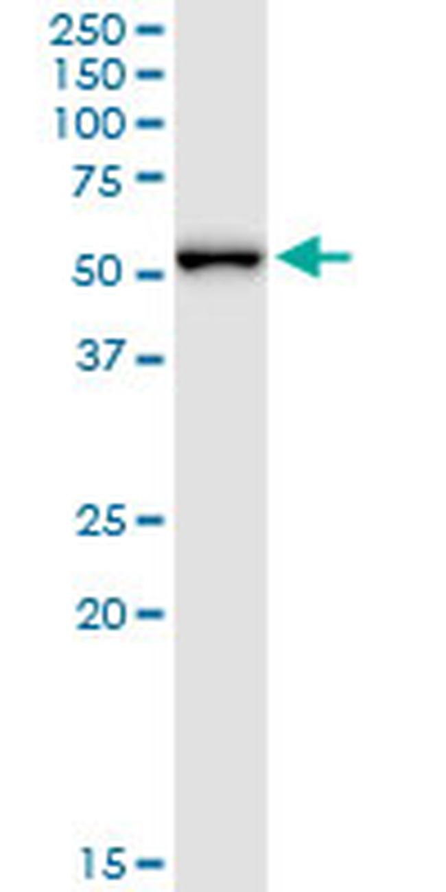 MPP1 Antibody in Western Blot (WB)