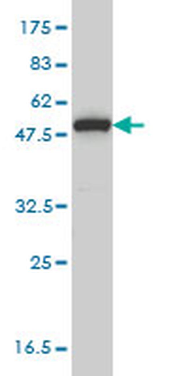 MPP1 Antibody in Western Blot (WB)