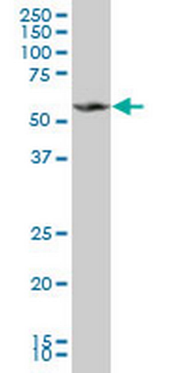 MPP1 Antibody in Western Blot (WB)