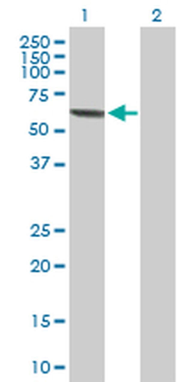 MPP2 Antibody in Western Blot (WB)