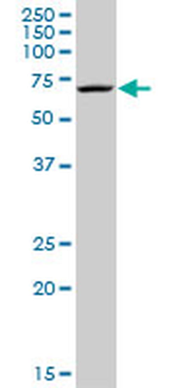 MPP2 Antibody in Western Blot (WB)