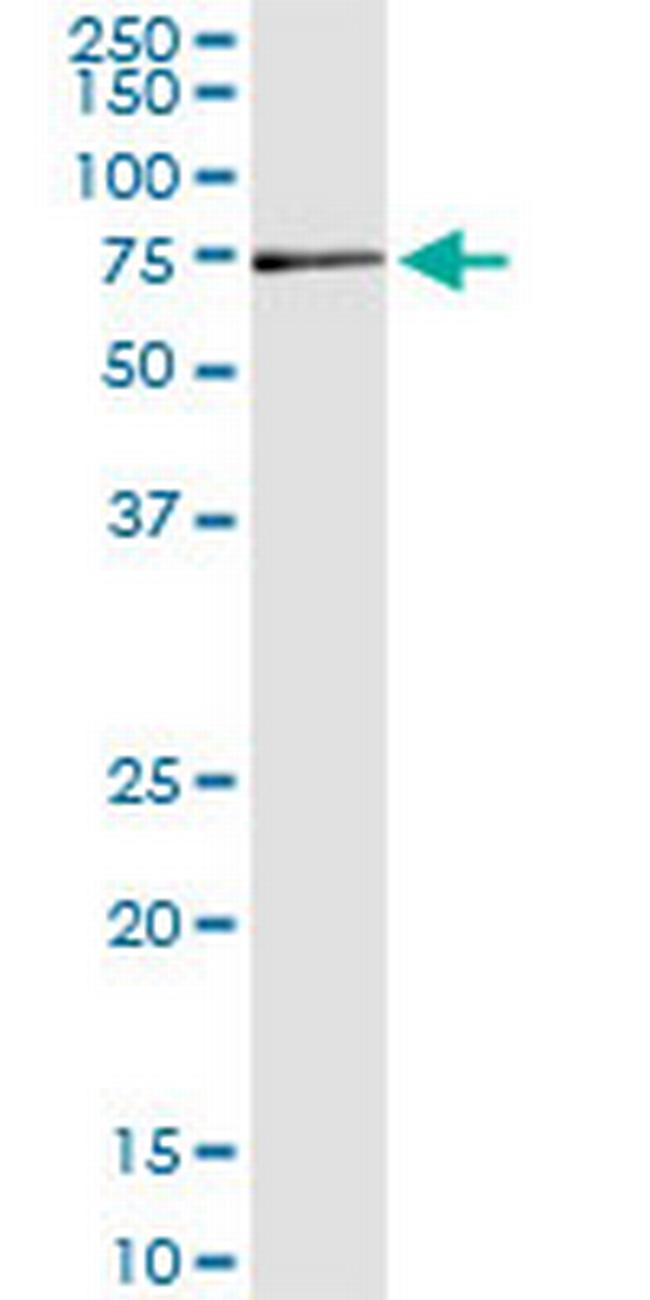 MPP2 Antibody in Immunoprecipitation (IP)