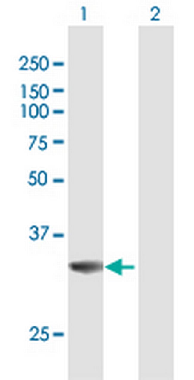 MPST Antibody in Western Blot (WB)