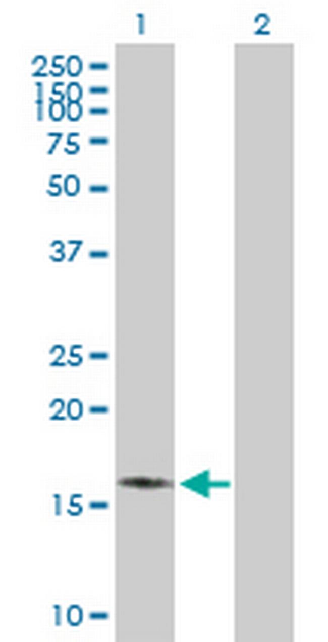 MPV17 Antibody in Western Blot (WB)