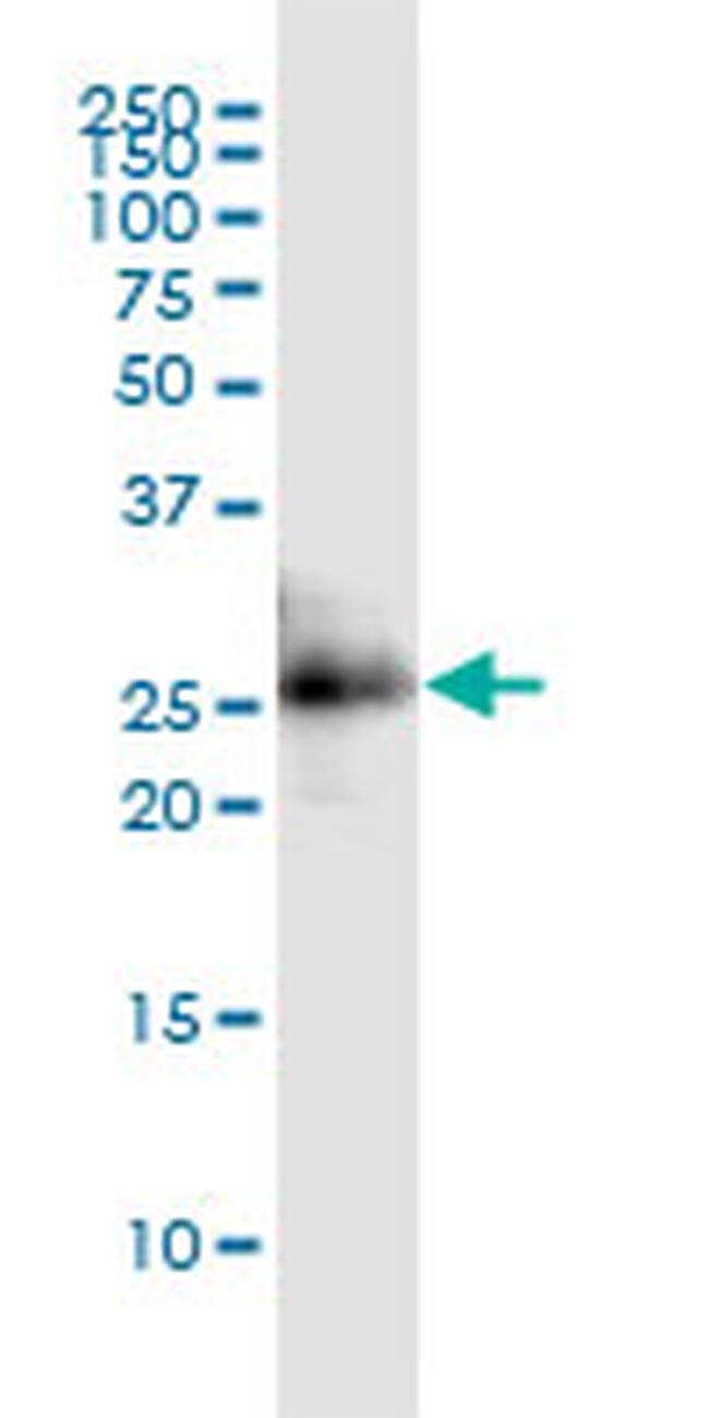 CITED1 Antibody in Western Blot (WB)