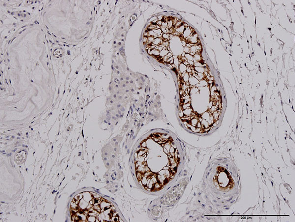 CITED1 Antibody in Immunohistochemistry (Paraffin) (IHC (P))