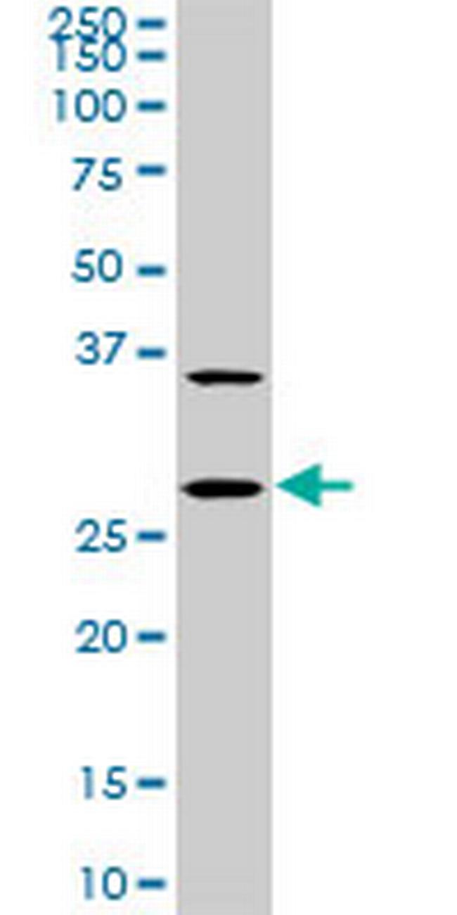 CITED1 Antibody in Western Blot (WB)