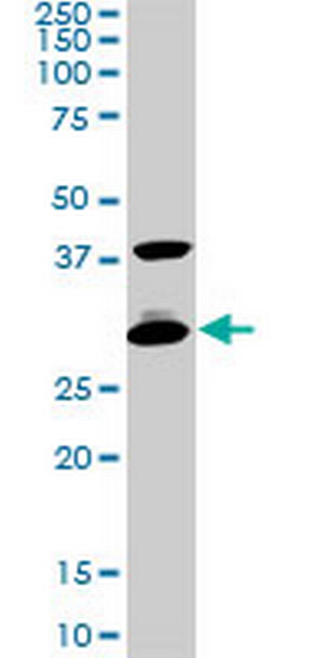 CITED1 Antibody in Western Blot (WB)