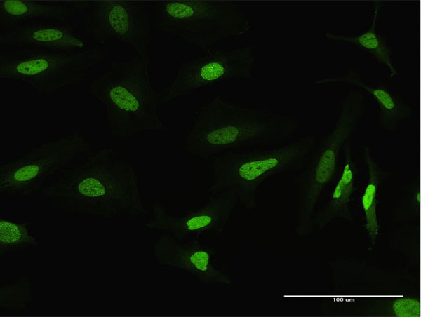 MSH2 Antibody in Immunocytochemistry (ICC/IF)