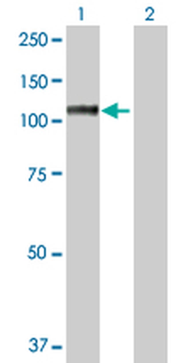 MSH2 Antibody in Western Blot (WB)